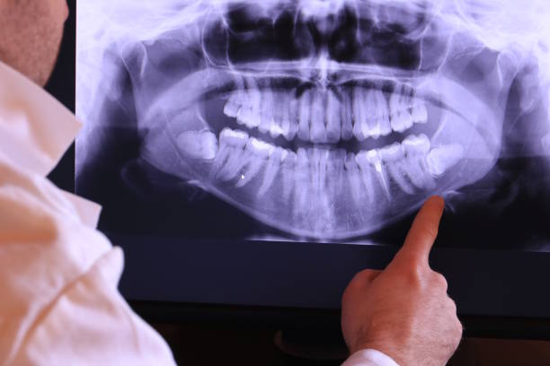 Dentist for Dental Trauma in TX